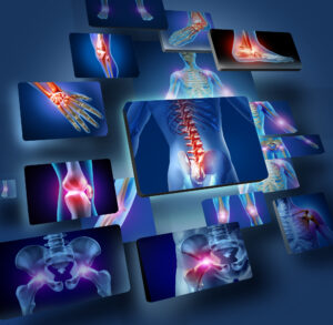 Personal Injury Lawyer Winder, GA - Human Joints Concept