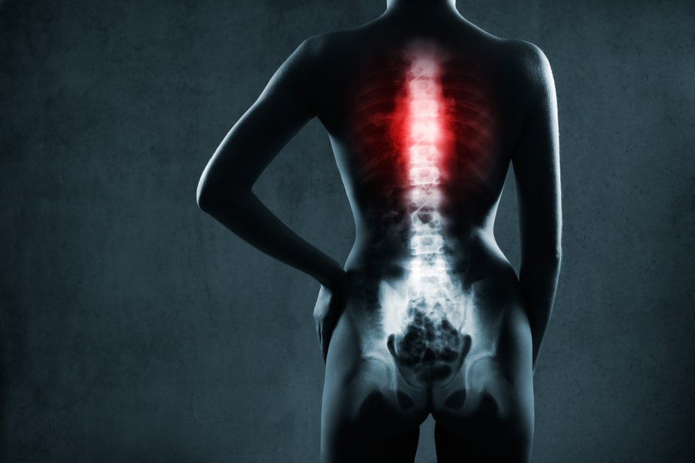 spinal cord injury lawyer Lawrenceville, GA
